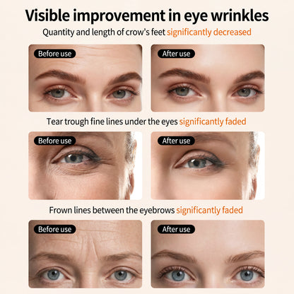 SpectraEye™ | 3-Minute LED Anti-Aging Eye Therapy